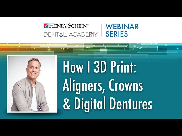 How I 3D Print: Aligners, Crowns & Digital Dentures