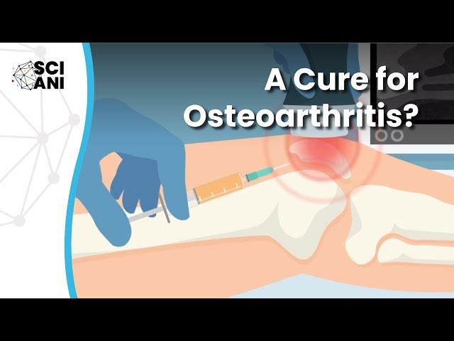 Breakthroughs in Osteoarthritis treatment