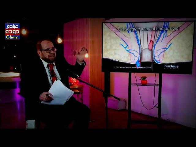 البواسير والشرخ الشرجى | دكتور جودة محمد عواد | دكتور جودة محمد عواد