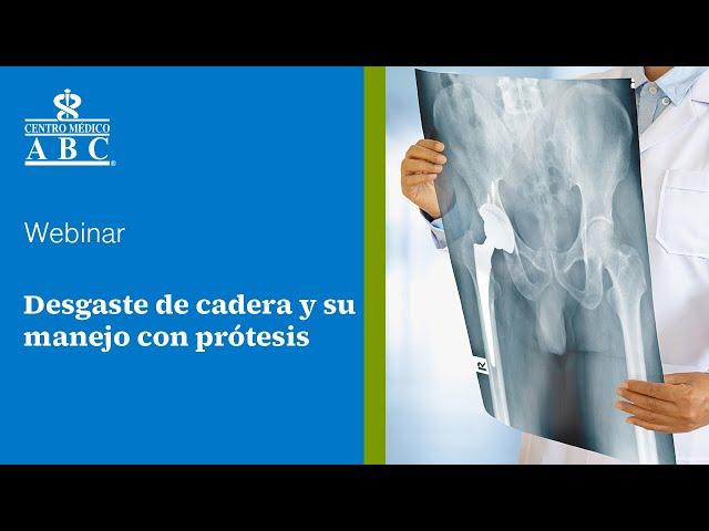 Webinar: desgaste de cadera y su manejo con prótesis