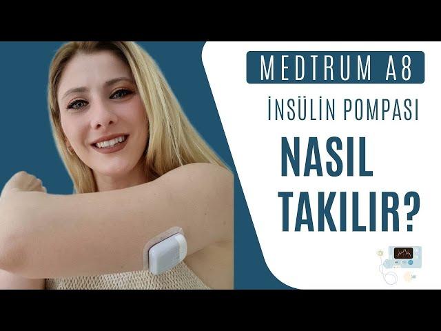 Medtrum A8 İnsülin Pompası: Akıllı Teknolojiyle Şeker Kontrolü