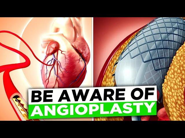 From the Wrist to the Heart: A Safer Route for Angioplasty