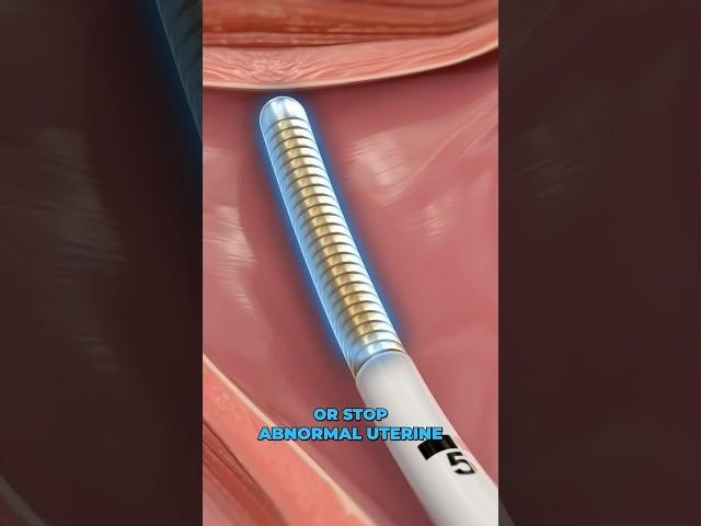 Using cold to stop menstrual bleeding (3D Animation)