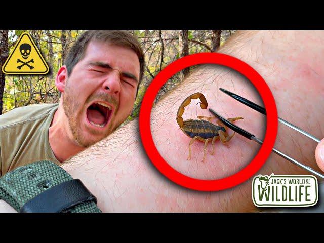 STUNG By A BARK SCORPION! How Bad Is IT?