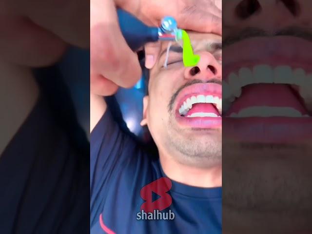 Amazing Video How a Medical Balloon Can Change Everyt ‼️
