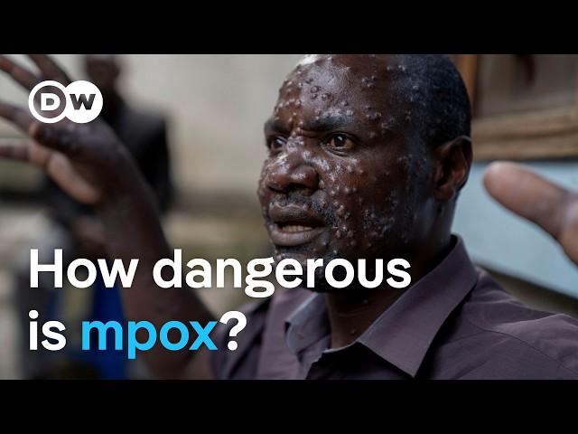 New mpox virus: Why is it spreading so quickly? | DW News