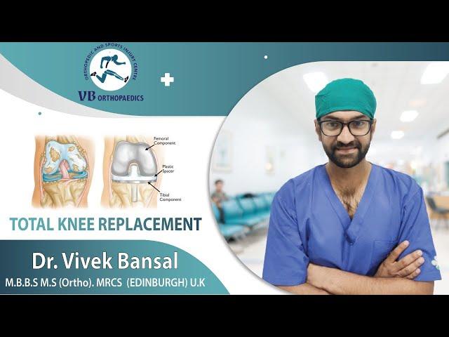 Osteoarthritis knee# back to life# best knee and shoulder surgeon# Dr Vivek Bansa# Bathinda