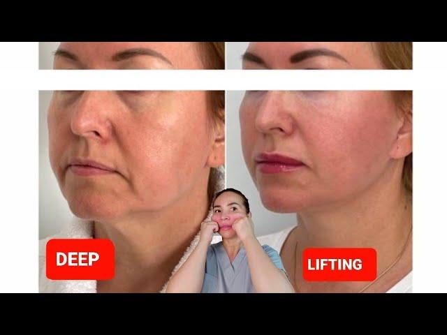 DEEP LIFTING massage | Sagging Jowls | Nasolabial Folds | Double chin