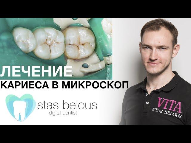 #Лечение #Кариес В МИКРОСКОП Вид от первого лица с моими комментариями Стас Белоус Врач стоматолог