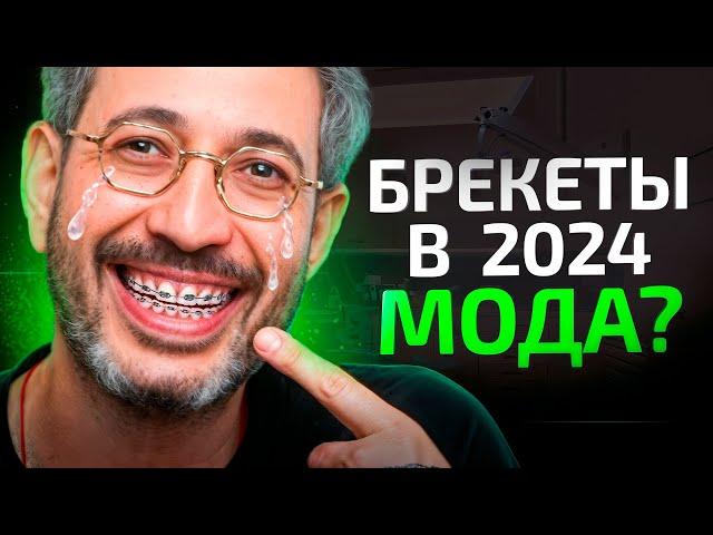 Брекеты в 2025 году – МОДА или НЕОБХОДИМОСТЬ