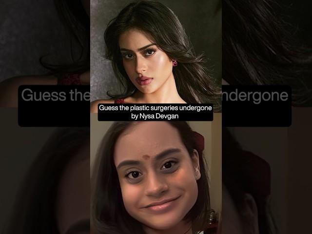 How many surgeries has Nysa Devgn undergone?