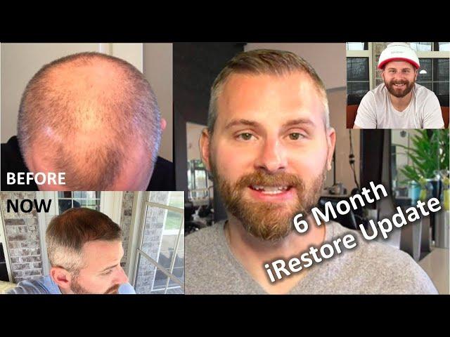 6 MONTH Review & Results from iRestore Low Level Laser Therapy (LLLT)