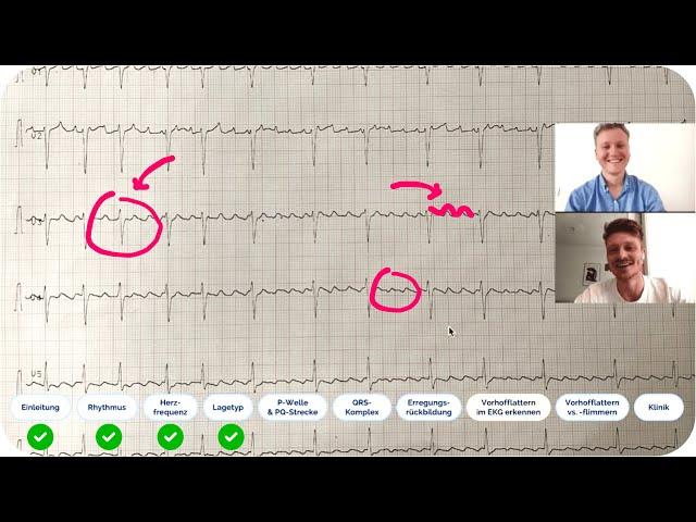 EKG befunden: Echtes EKG-Fallbeispiel mit ärztlicher Auswertung - Kommst du auf die Diagnose?