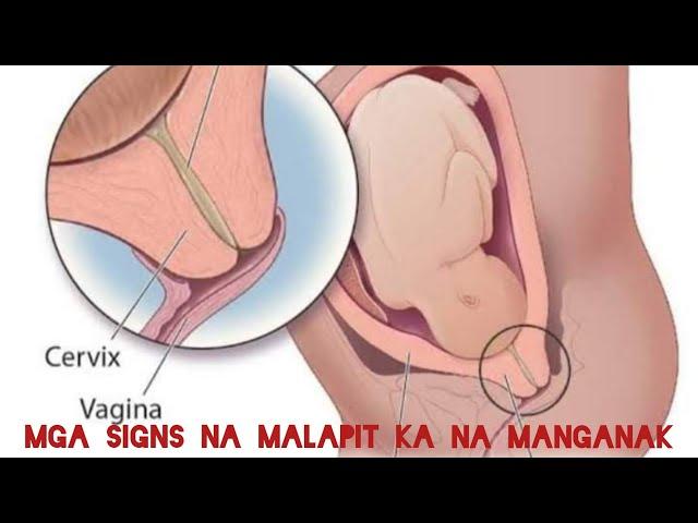 Senyales na Manganganak Ka Na! (SIGNS OF LABOR) | Violeta Gonzales