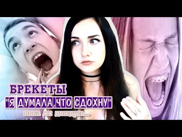 БРЕКЕТЫ|БОЛЬ,ПЕРВЫЕ ДНИ,УСТАНОВКА,ФОТО ДО И ПОСЛЕ.