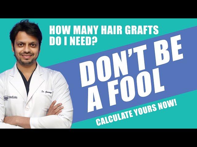 {2024} How Much GRAFTS You Need For Hair Transplant | हेयर ट्रांसप्लांट में आपको कितने ग्राफ्ट चाहिए