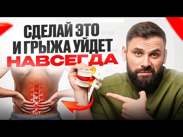 Межпозвонковая грыжа – как избежать операции? Все причины образования грыжи в этом видео