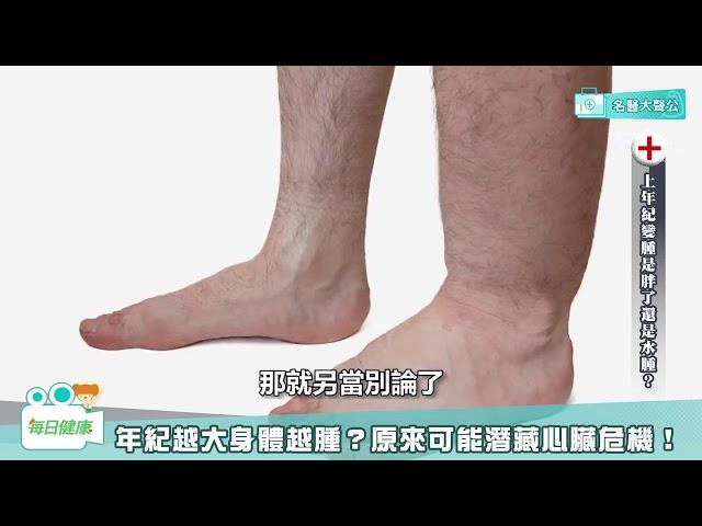 水腫可能是大病來襲前兆？腎水腫和心臟水腫怎麼分？