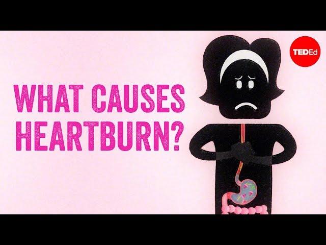 What causes heartburn? - Rusha Modi