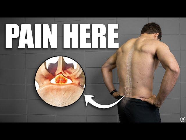 Lumbar Spinal Stenosis Rehab (Education | Exercises | Surgery | Myths)