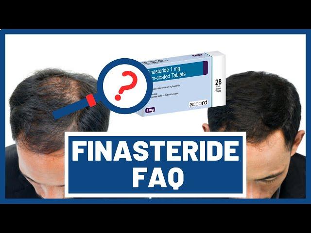 Finasteride FAQs (Dosage, Costs, and Finasteride Side Effects)