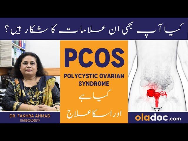 Polycystic Ovarian Syndrome In Urdu - PCOS Ka Ilaj - PCOS Treatment At Home - PCOS Kya Hota Hai