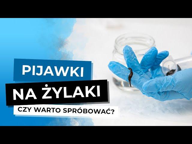 Pijawki Na Żylaki. Czy Pijawki Pomagają Na Żylaki?