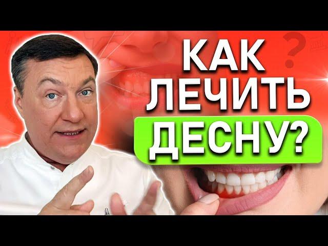 Как лечить ВОСПАЛЕНИЕ десны в домашних условиях? Гингивит и пародонтит.