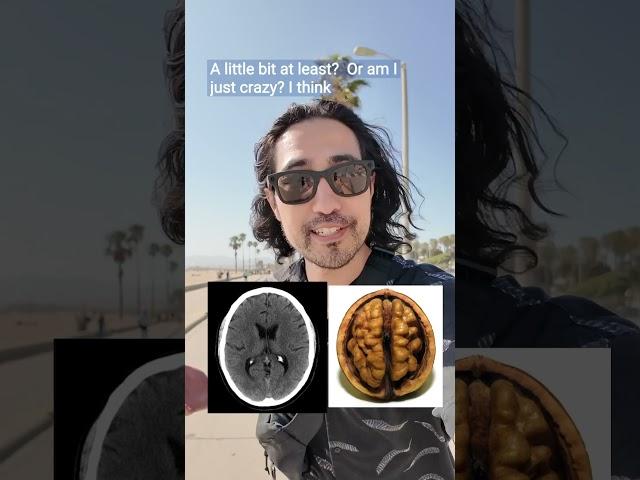 CT Scan of the Brain:  Normal or Not? #doctor #CTHead #venicebeach
