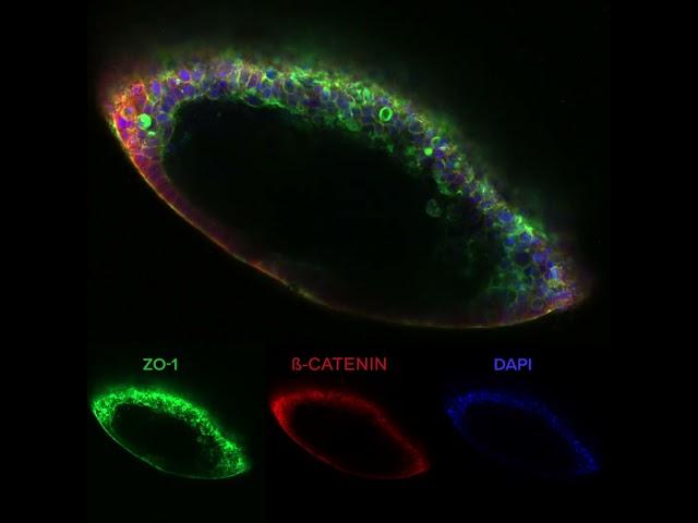 Webinar: Apical-out Organoid Data using VitroGel® ORGANOID