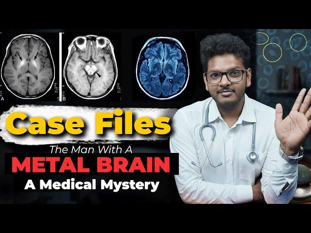 Case Files Ep5 - The Man With A Metal Brain | Dr. Anuj Pachhel