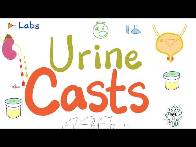 Urine casts (WBCs, RBCs, Waxy, Hyaline, Granular, Epithelial, Fatty)