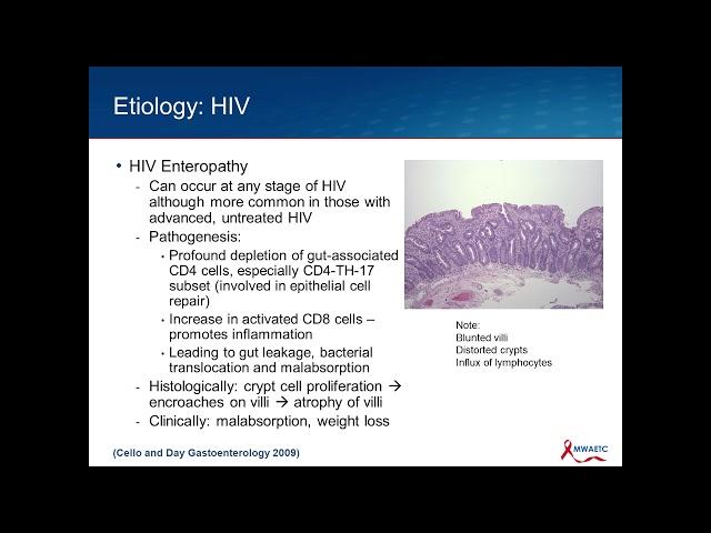 HIV Associated Diarrhea