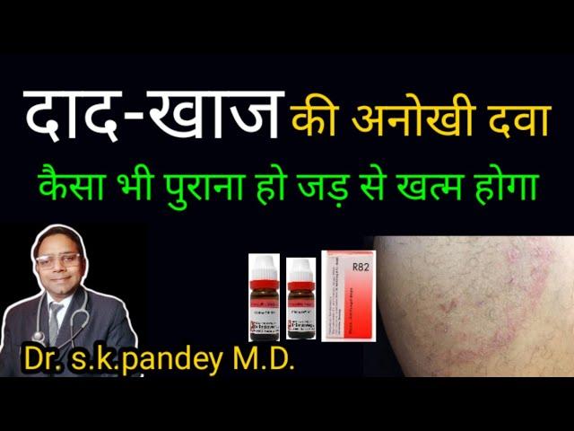 दाद की समस्या जड़ से ख़त्म करें Dr. s.k.pandey M.D.