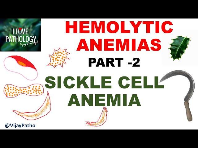 Hemolytic Anemias- Part 2: SICKLE CELL ANEMIA- Pathology