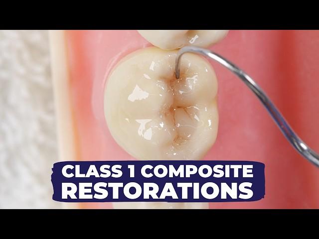 Class I Composite Restoration: How to | Simple Vs Fancy Technique with Dr Lincoln Harris