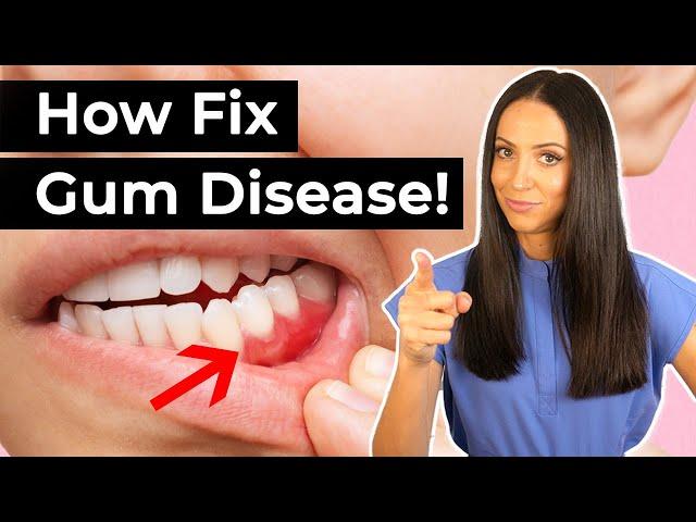 If You Have Gum Disease... Do This!