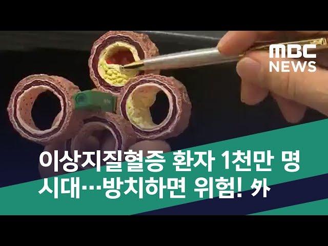 [스마트 리빙] 이상지질혈증 환자 1천만 명 시대…방치하면 위험! 外 (2018.10.02/뉴스투데이/MBC)