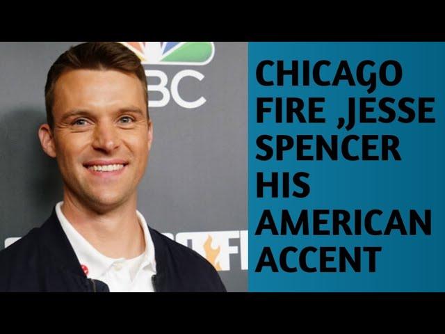 Accent Mastery: Jesse Spencer's Versatility in Portraying American Characters