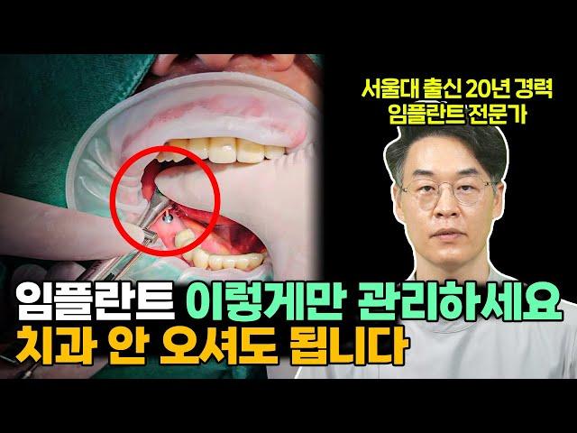 임플란트 치아 관리 총정리, 이 영상 하나면 됩니다