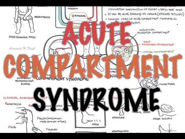 Compartment Syndrome - Overview (signs and symptoms, pathophysiology, treatment)