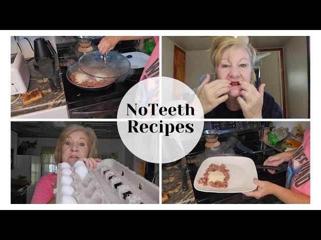 NO TEETH Food Ideas / Full mouth tooth extraction foods to eat