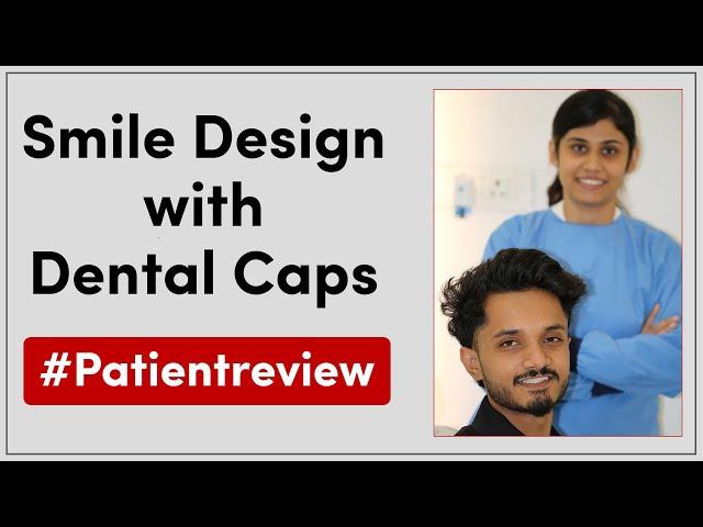 Smile Design with Dental Caps | Patient Review | Seraphic Dental, Indore