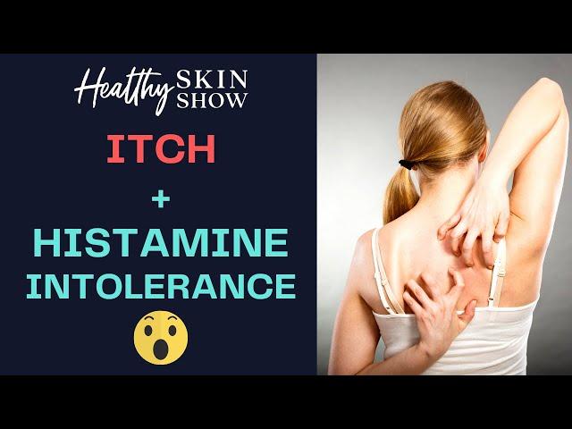 Itchiness + Histamine Intolerance - WHY Am I ITCHY? | Jennifer Fugo