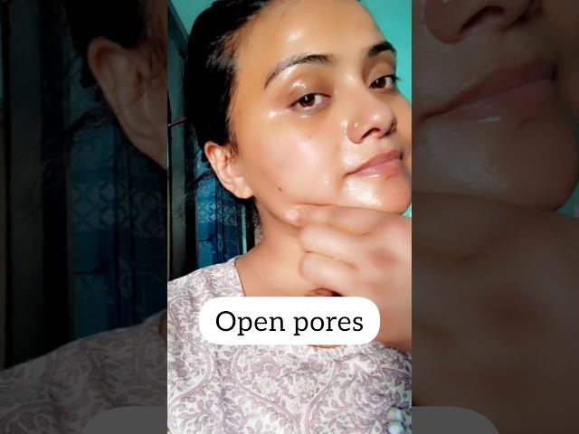 Dull Skin & Open Pores? 15 Min Mein Glow Karo #skincare #beauty #shorts #glowingskin