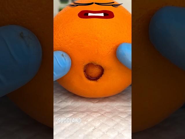 Goodland | Orange surgery  #goodland #shorts #doodles #doodlesart