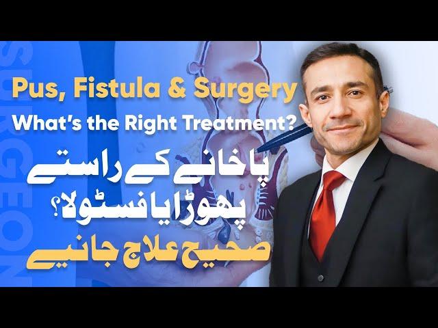 Pakhane Ke Rastay Phora Aur Fistula | Peep Nikalna, Operation Ya Laparoscopic Surgery? Full Guide