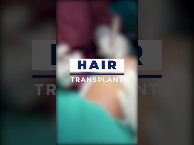 Hair Transplant Procedure | The Hair And Shape Clinic | Dr. Umang Kothari