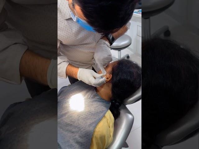 Intra Articular Injection for Chronic TMJ pain | Best Dental Hospital In India | Eledent Hospitals