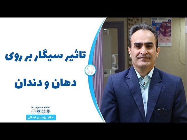 تاثیر سیگار بر روی دهان و دندان